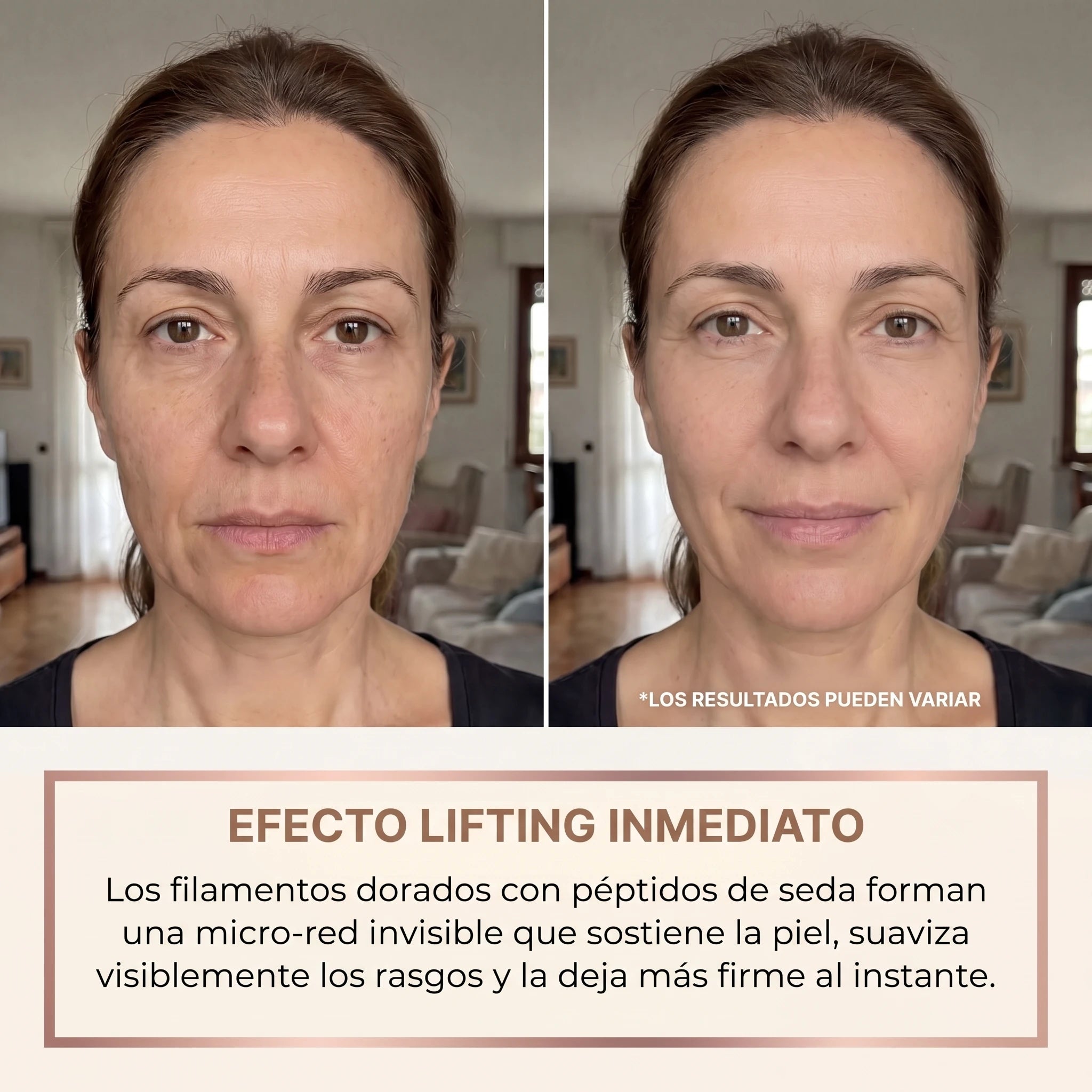 Antes y después del sérum lifting Nolia: efecto lifting inmediato