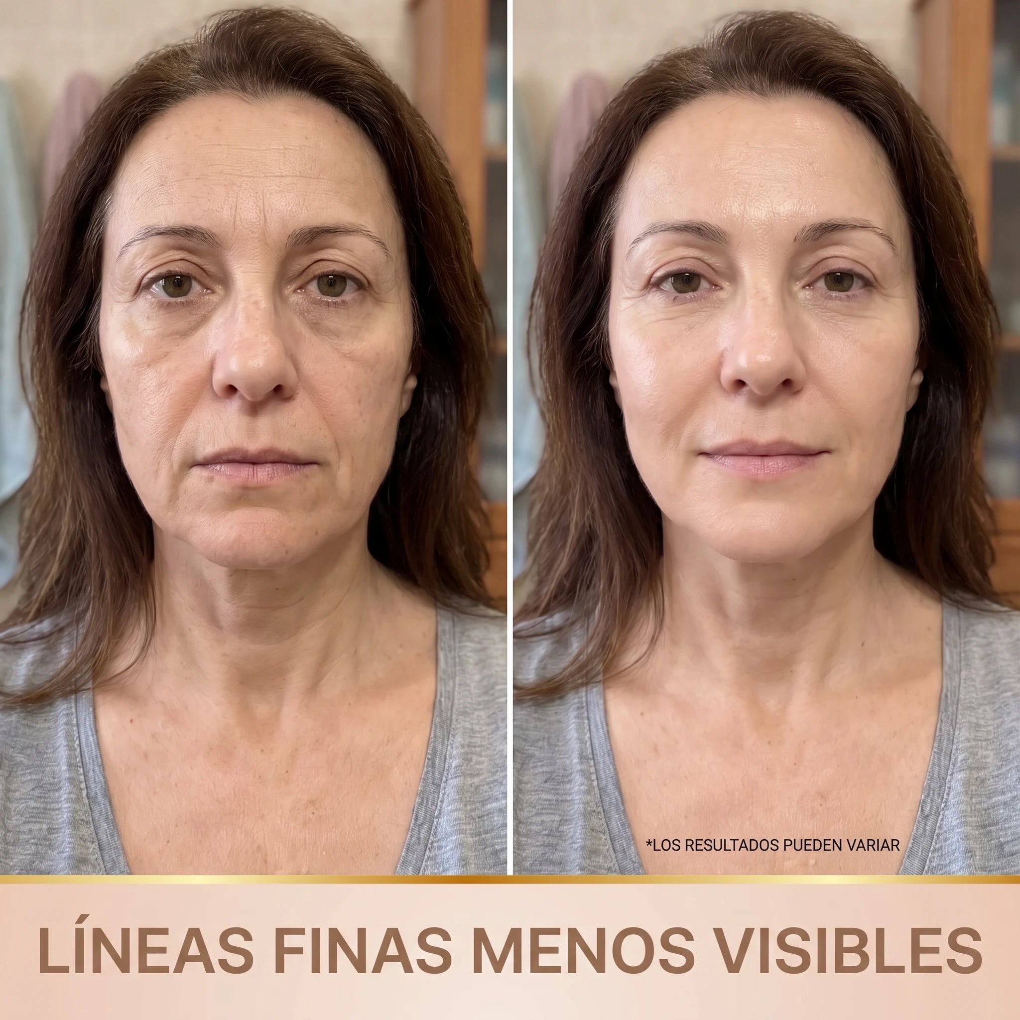 Antes y después: líneas finas menos visibles