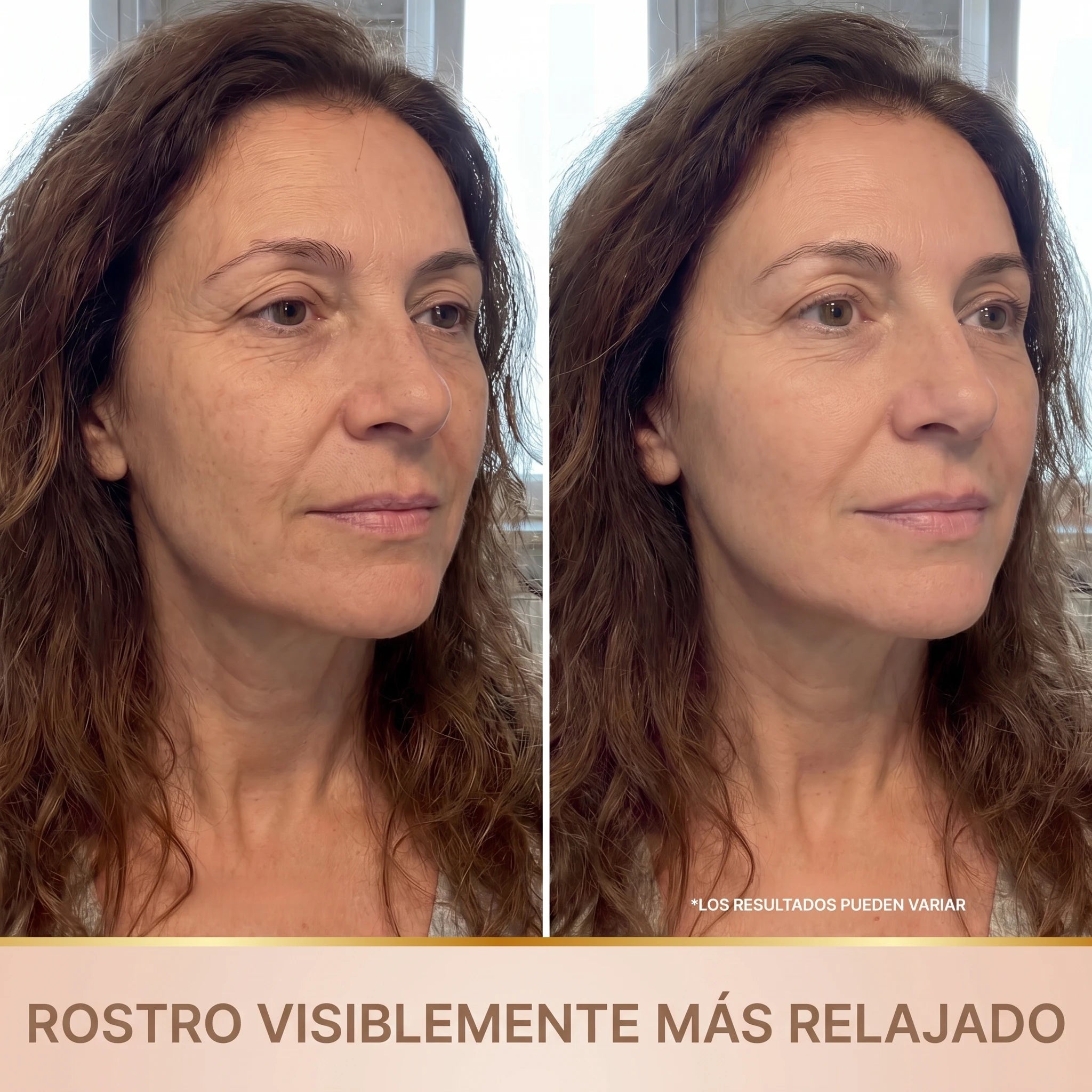 Antes y después: rostro visiblemente más relajado