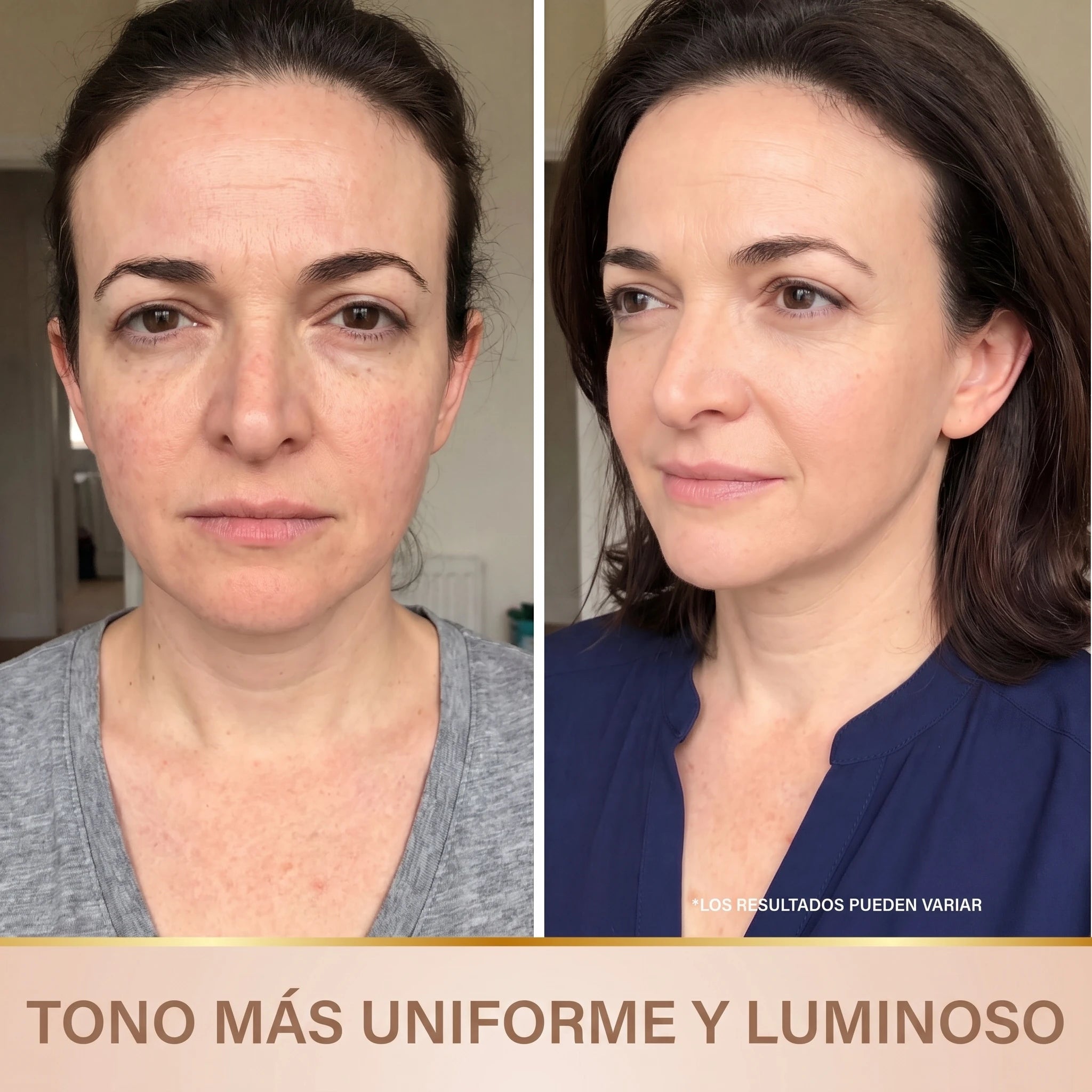 Antes y después: tono más uniforme y luminoso
