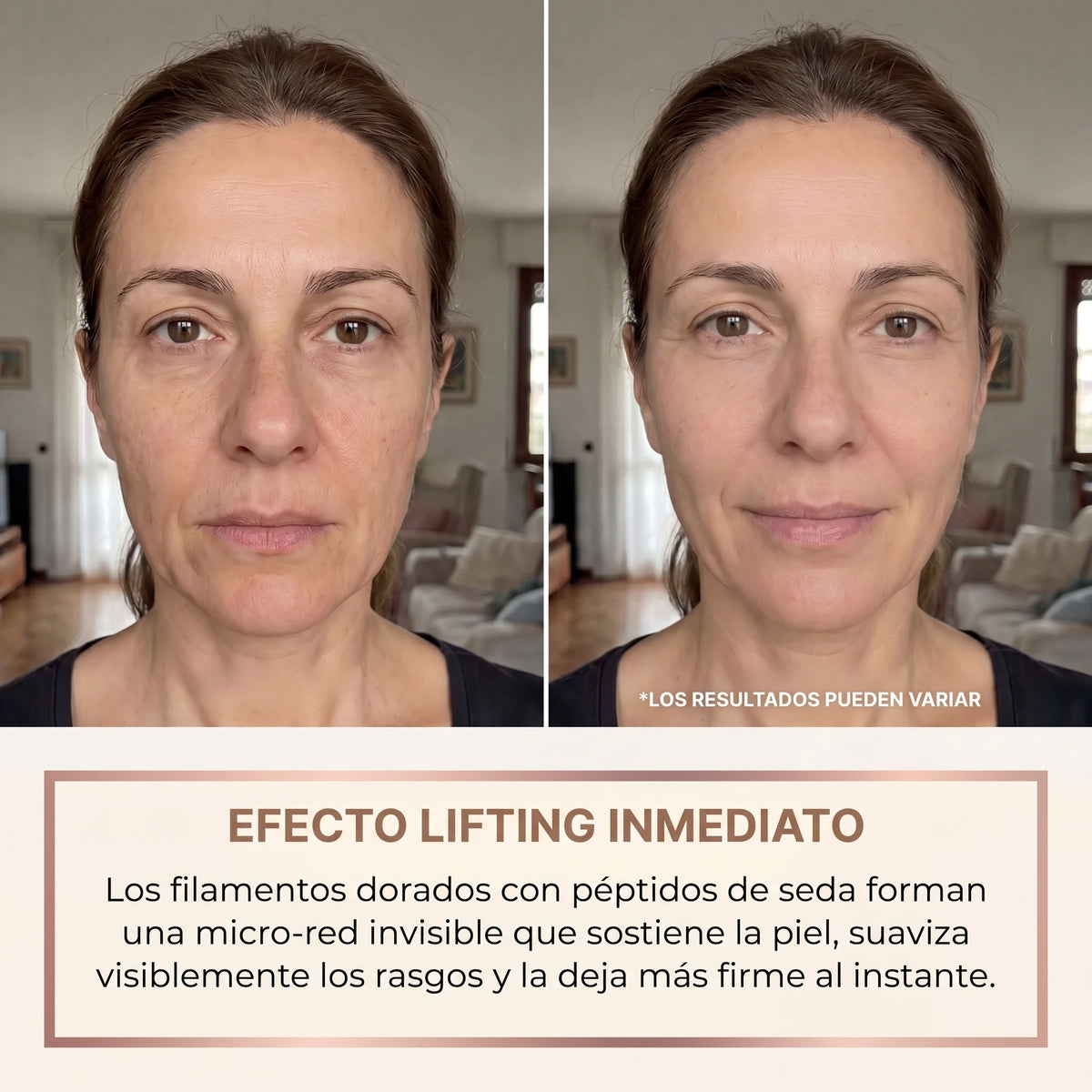 Antes y después del sérum lifting Nolia: efecto lifting inmediato
