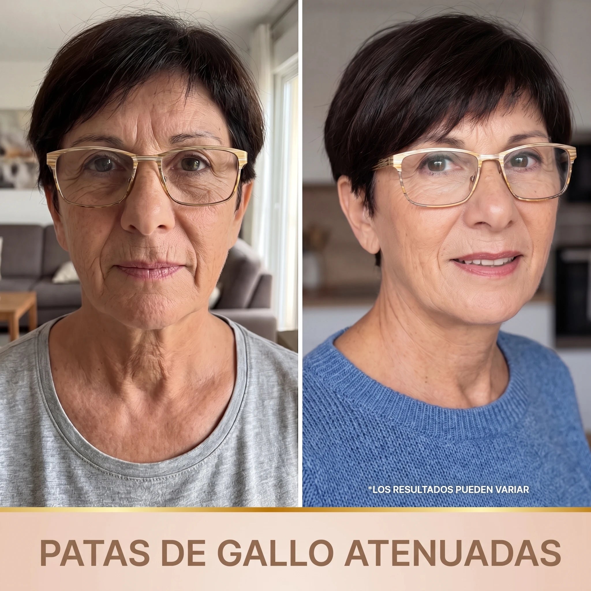 Antes y después: patas de gallo atenuadas